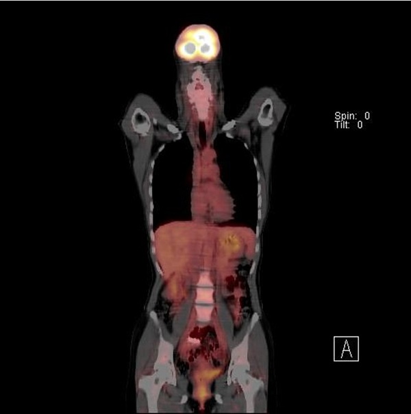 jpg摜FPET-CT2005N摜