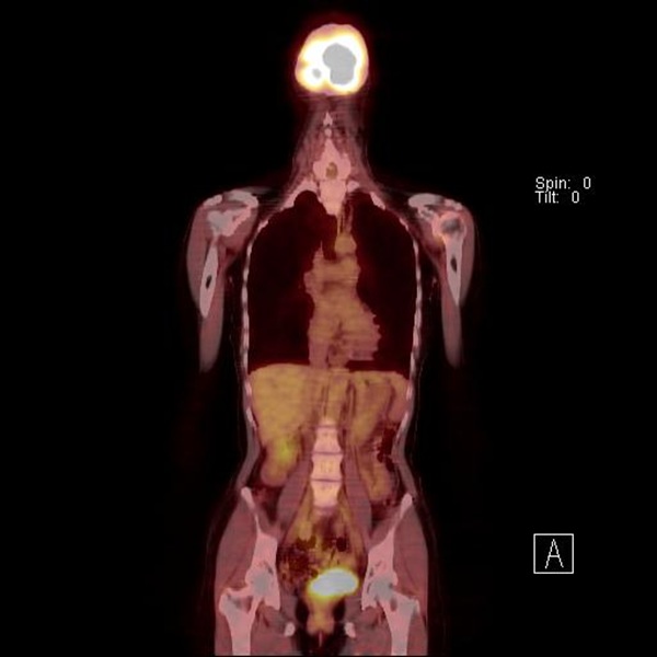 jpg摜FPET-CT2014N摜