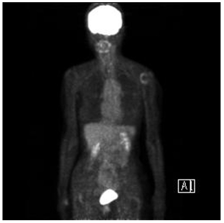 jpg摜FPET-CT@CT2014N摜