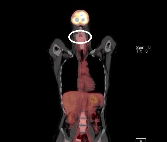 jpg摜FPET-CT2005NZbBǉ摜